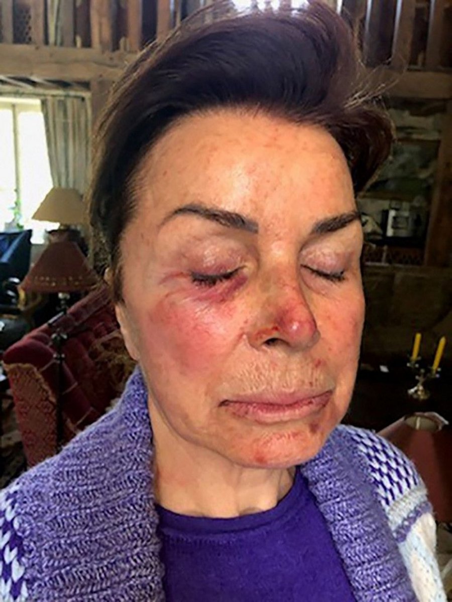 Bernard Tapie and his wife attacked by thieves in their home #2