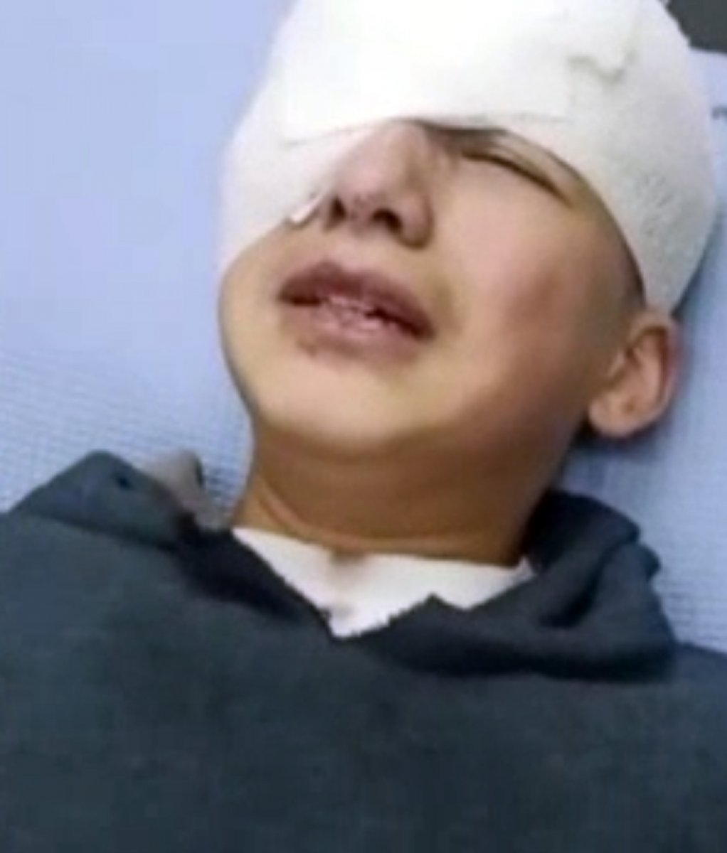 Israeli forces shot Palestinian boy in the eye with a rubber bullet #1