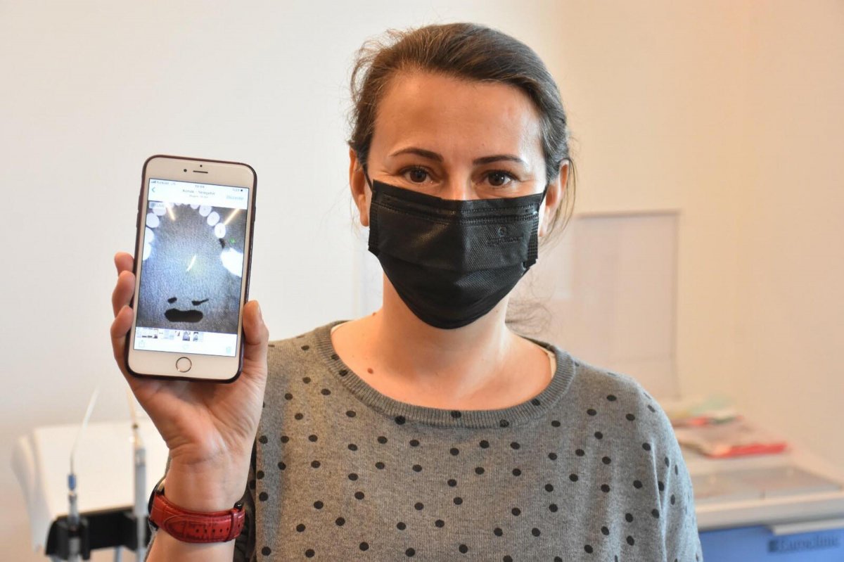 İzmir'de kokoreç yerken diline iğne batan kadın hastaneye koştu