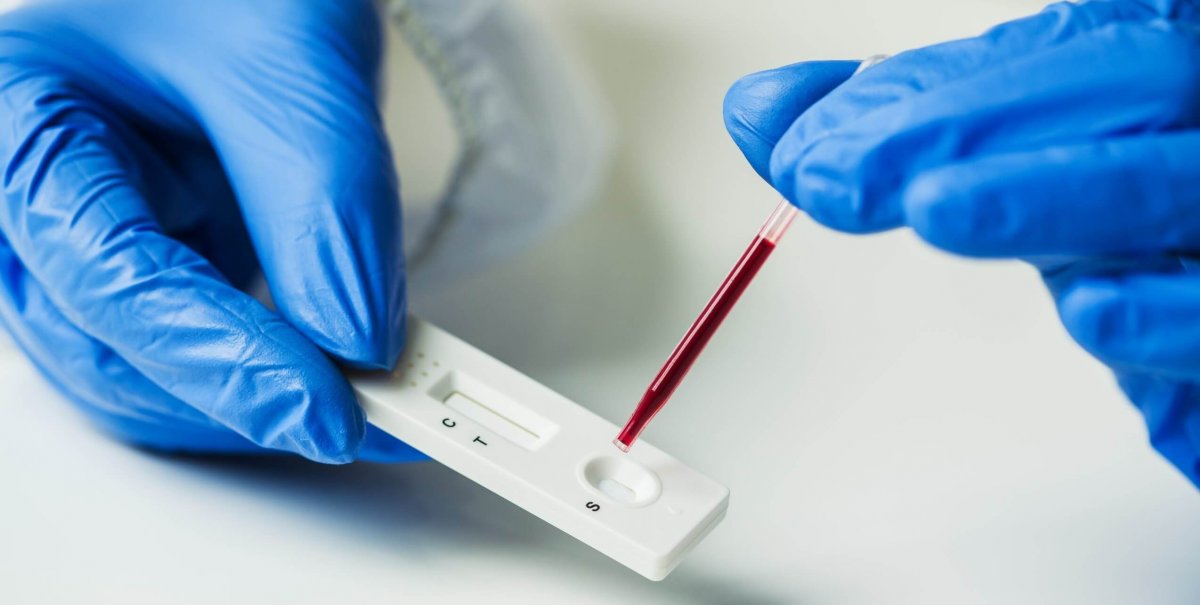 Antikor nedir, koronavirüse karşı korur mu? Antikor testi nasıl yapılır? #4