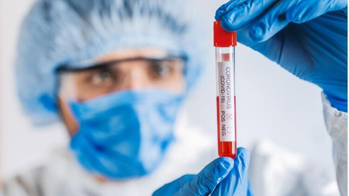 Antikor nedir, koronavirüse karşı korur mu? Antikor testi nasıl yapılır?