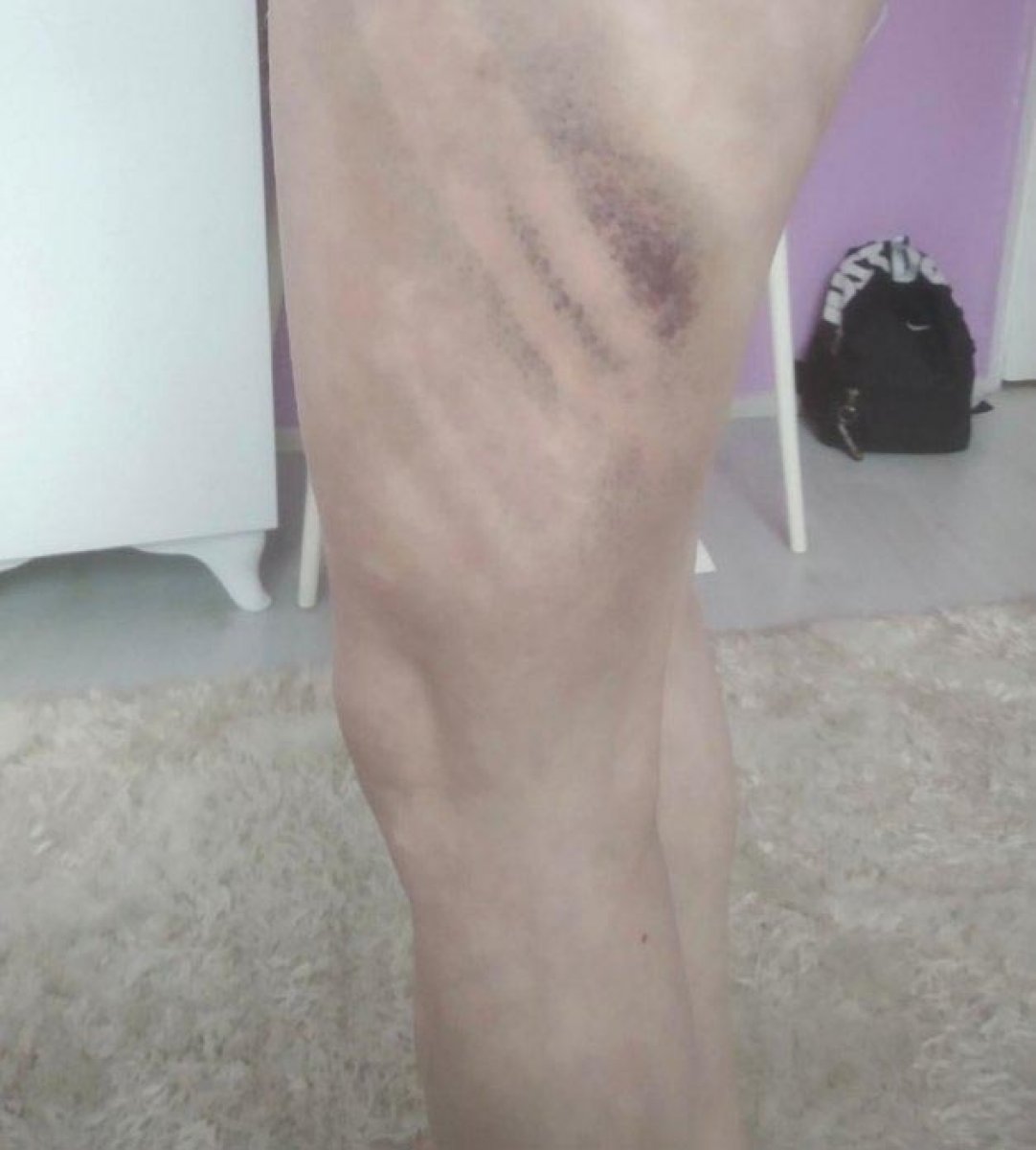 İzmir'de sevgiliye beyzbol sopasıyla şiddet: İddianame hazırlandı