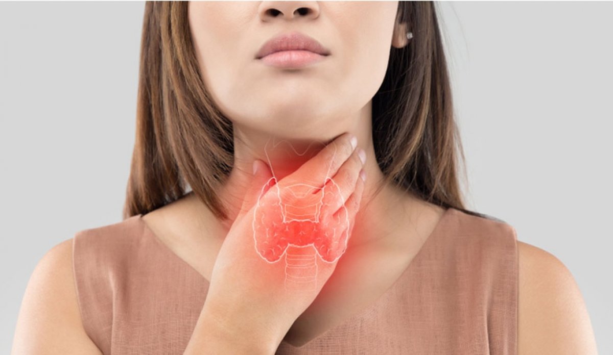 7 tips to cure thyroid problems #2