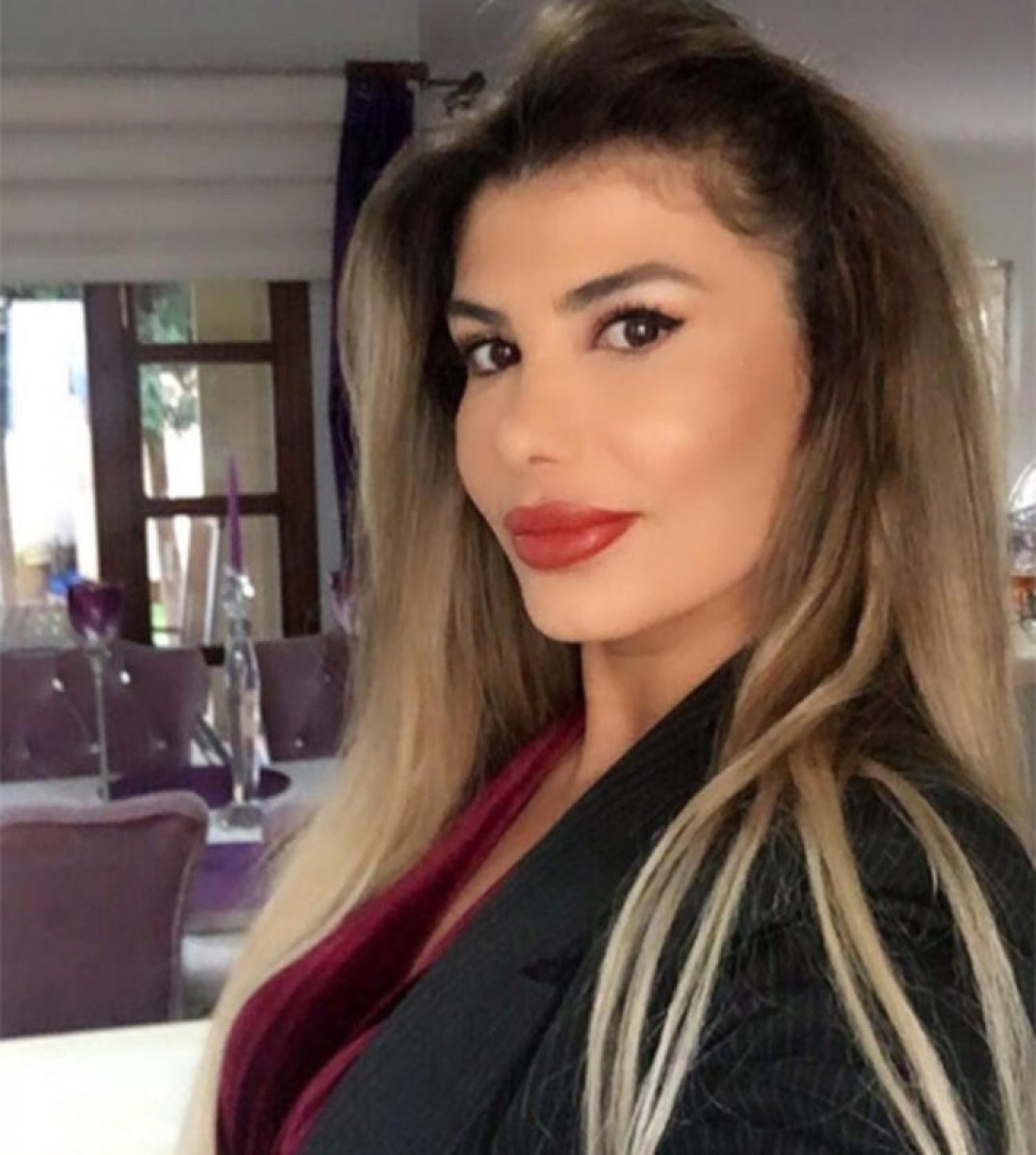 Hatice: Keşke estetik olmasaydım