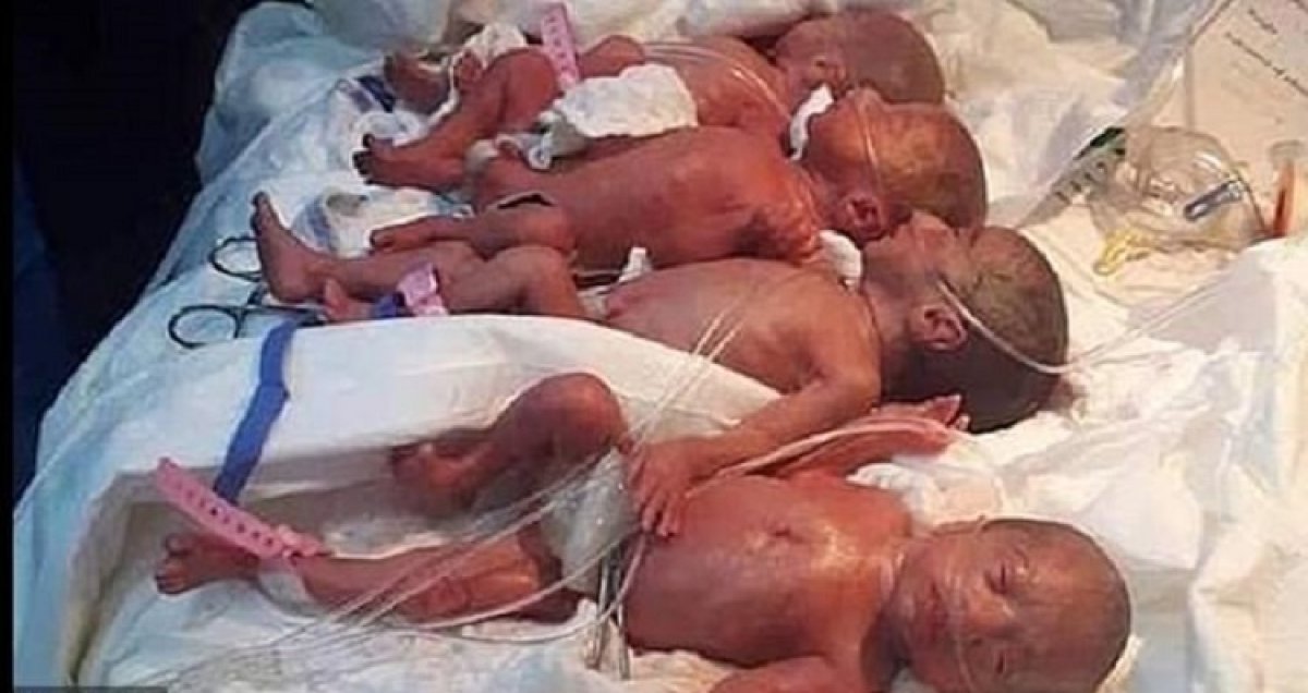 A woman gave birth in Morocco, 9 children were born #2