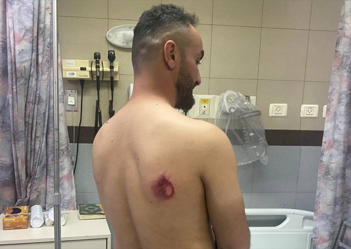 AA’nın Ortadoğu Editörü, Mescid-i Aksa saldırısında yaralandı #2