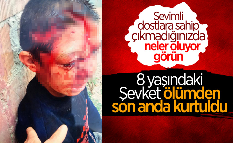 Kastamonu’da 8 yaşındaki çocuğa köpek saldırdı