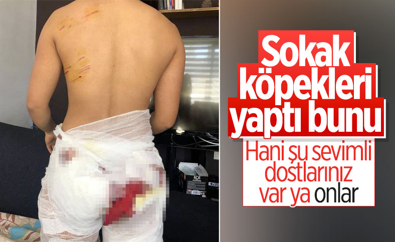 Antalya'da sokak köpeklerinin saldırdığı Endonezyalı kadın ağır yaralandı