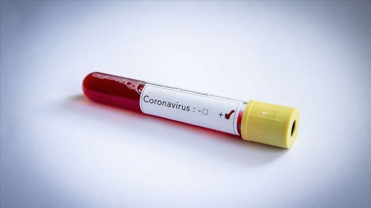 Does the contagiousness of the coronavirus decrease in summer #2