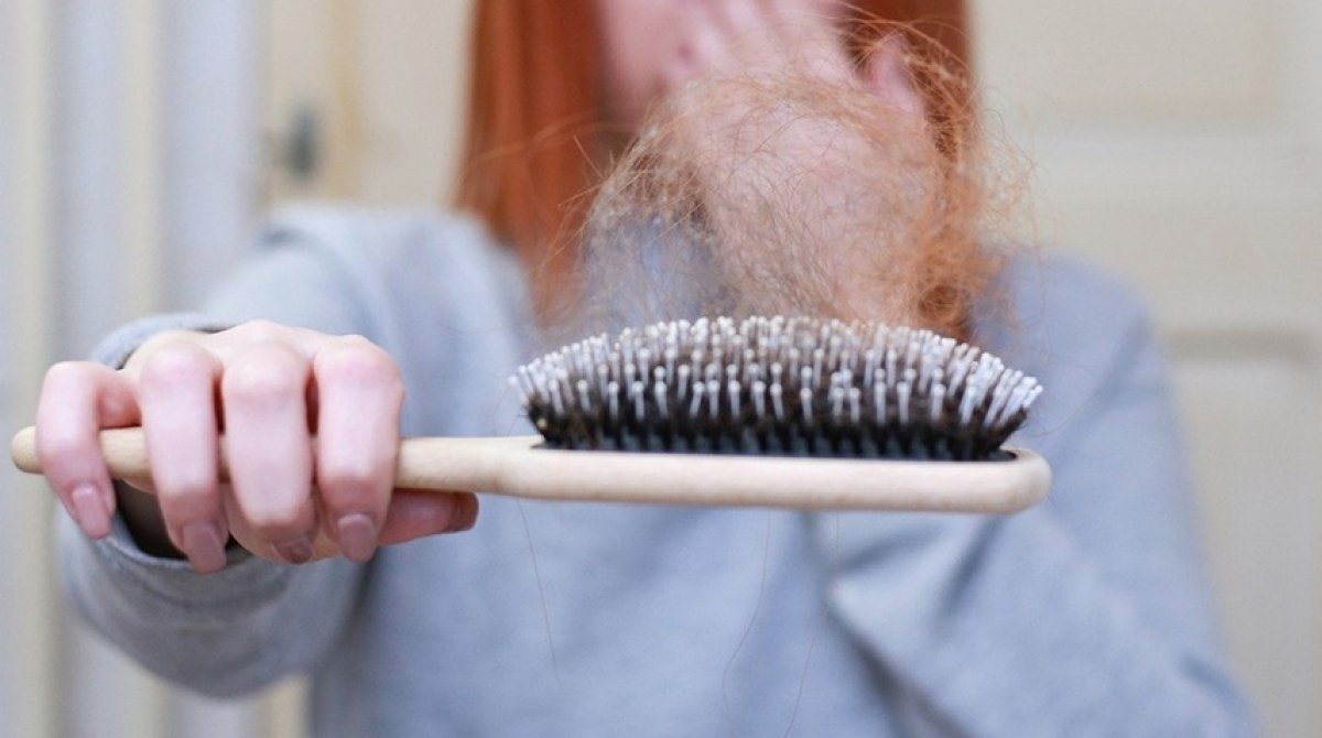 11 natural remedies to prevent hair loss #1