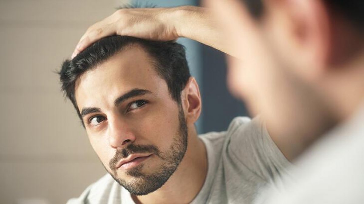 11 natural remedies to prevent hair loss #2