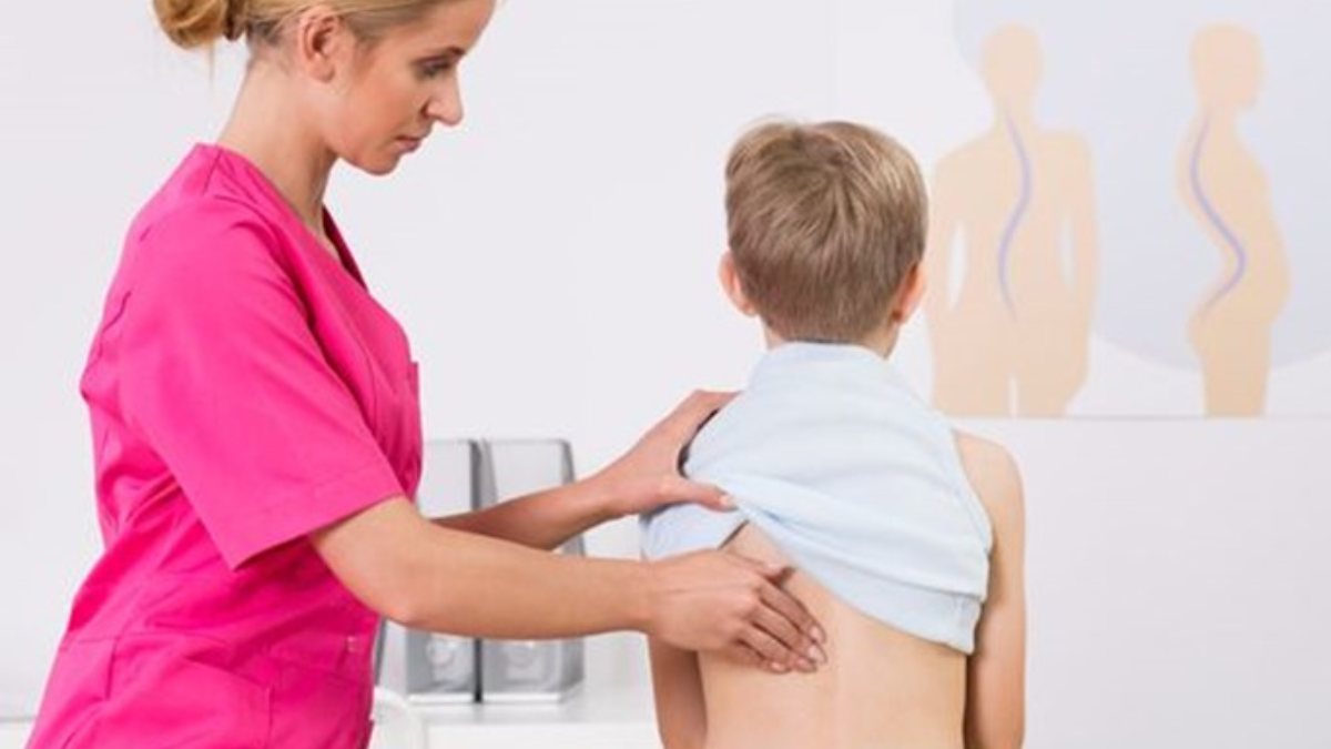 Scoliosis affects lungs and heart in children – Kimdeyir