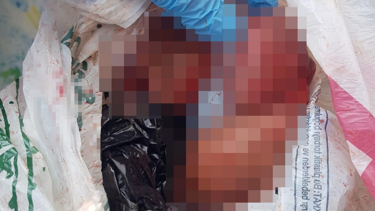 Antalya’da düşük yapan kadın bebeğini çöpe attı