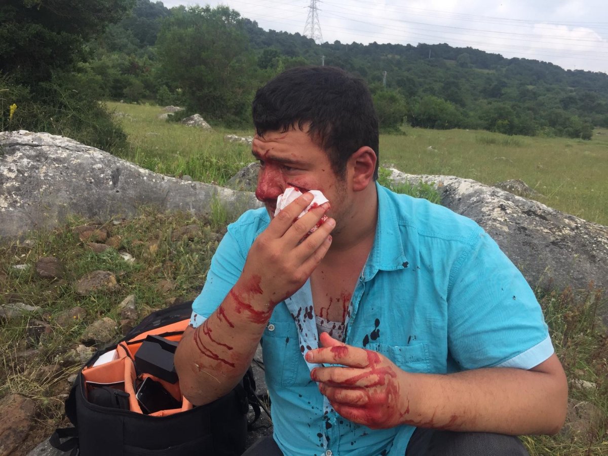 Lütfü Türkkan’ın adamları İHA muhabirine saldırdı #3