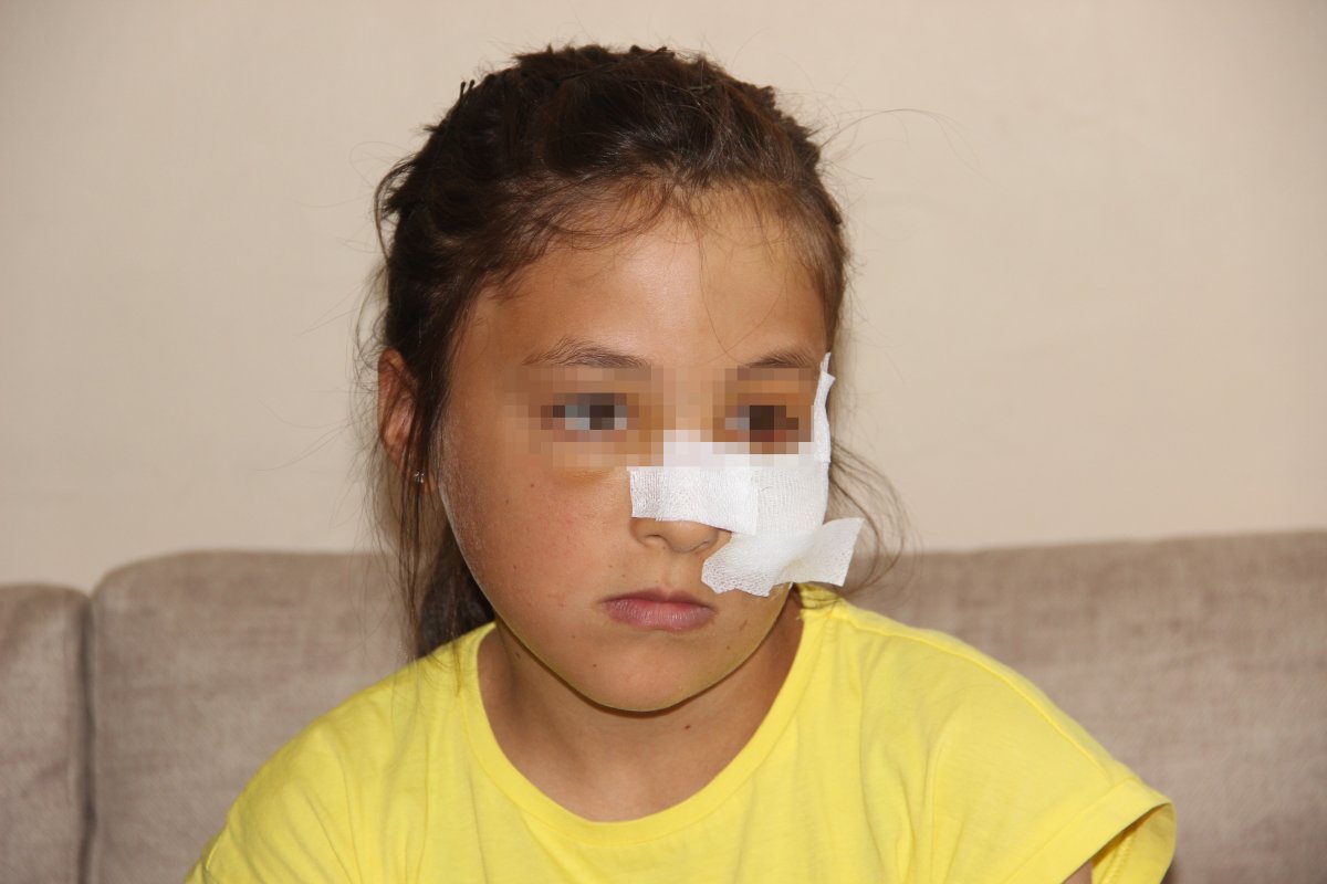 Erzurum da 10 yaşındaki kuzenine demir boruyla saldırdı #1