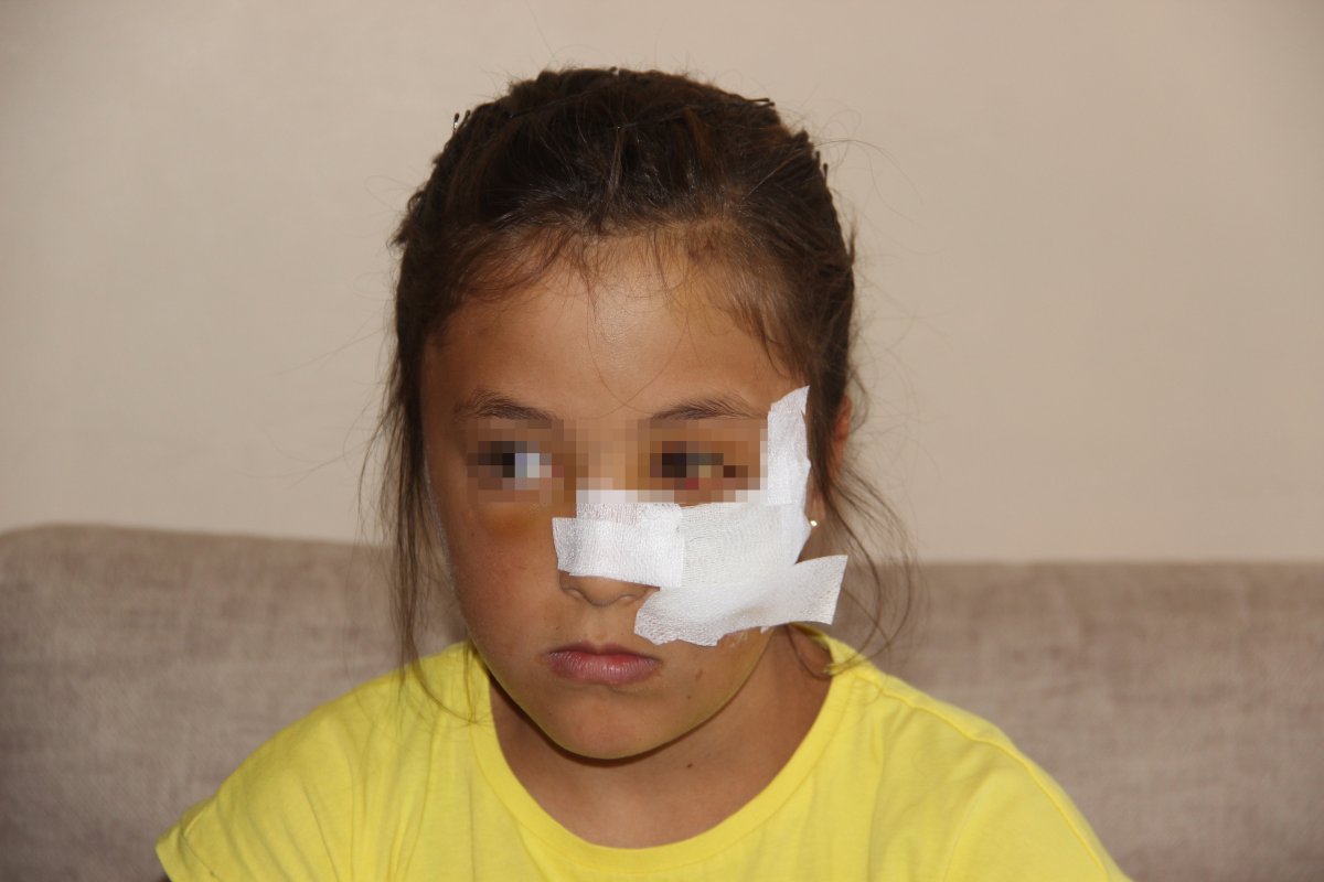 Erzurum da 10 yaşındaki kuzenine demir boruyla saldırdı #3