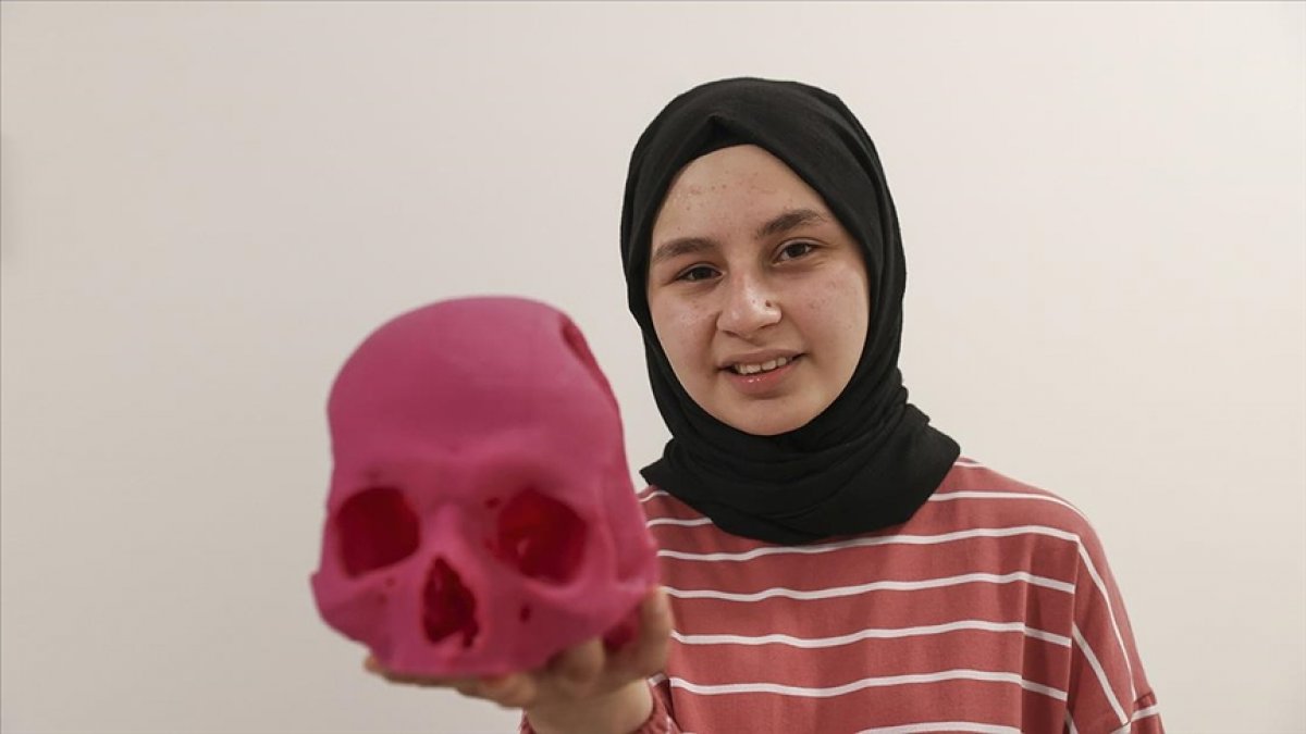 An artificial skull was transplanted to Gizemnur, who was in a traffic accident #2