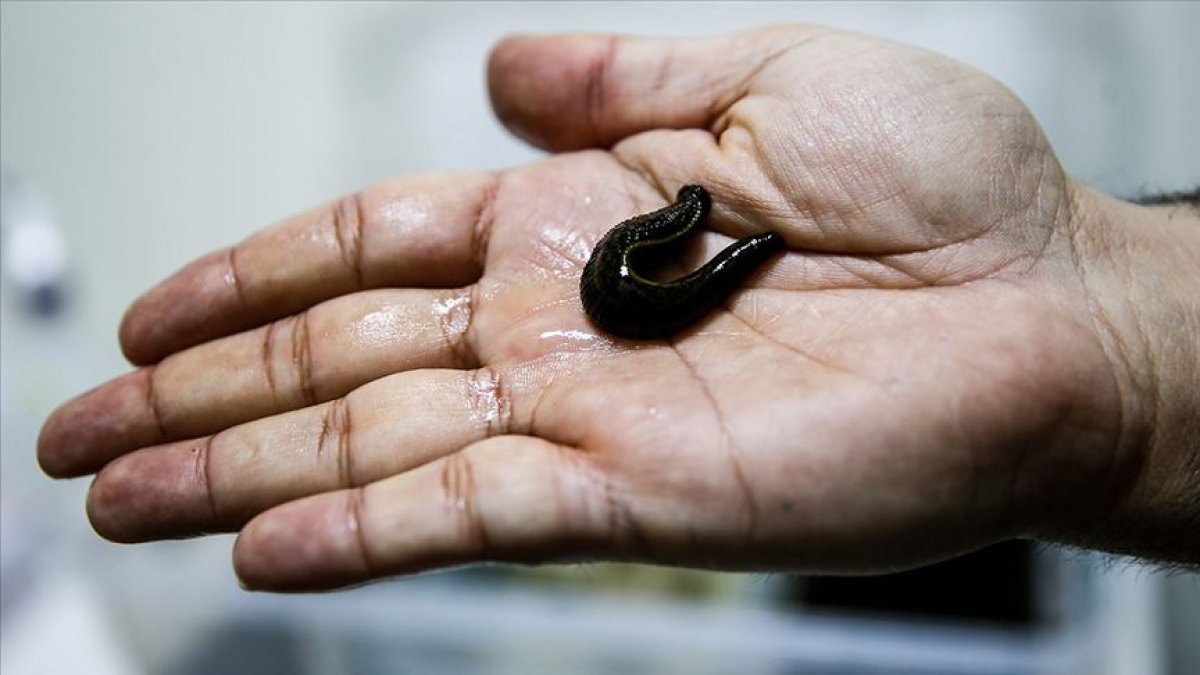 A leech cancer vaccine is being developed at Erciyes University #2