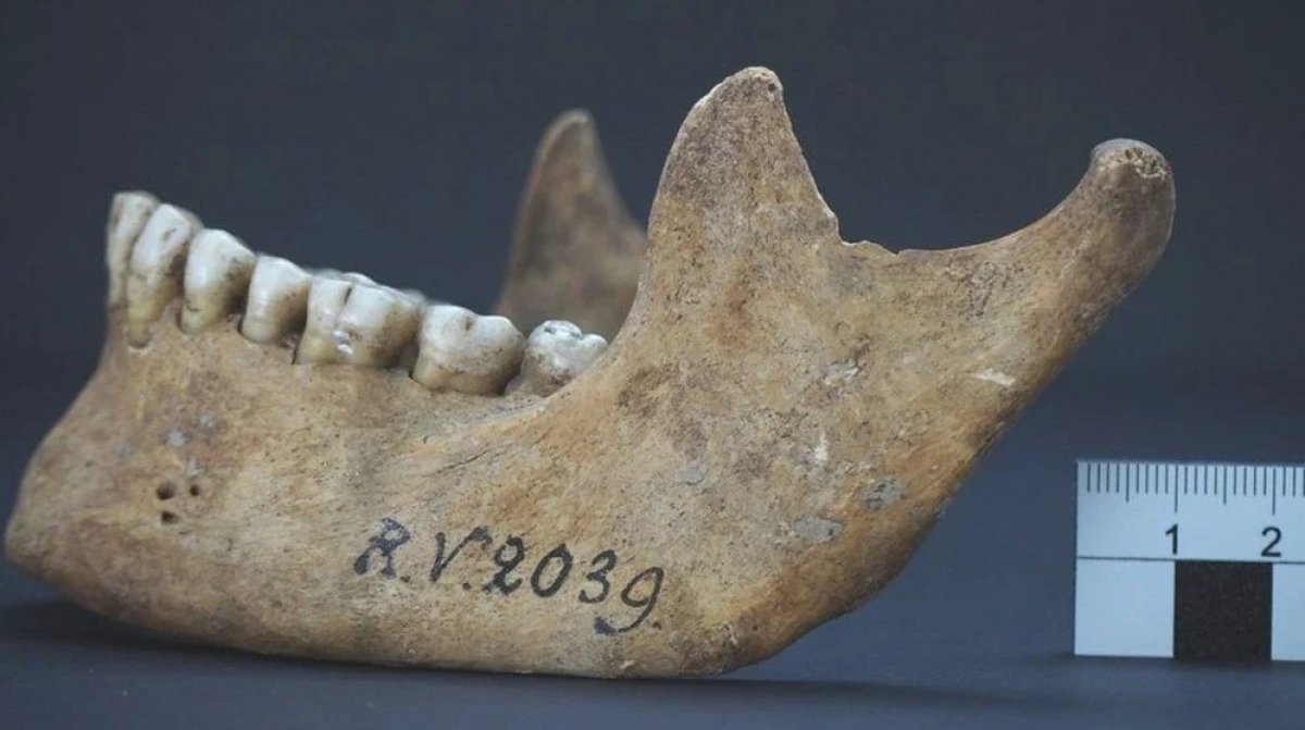First case found in Black Death that swept Europe #4