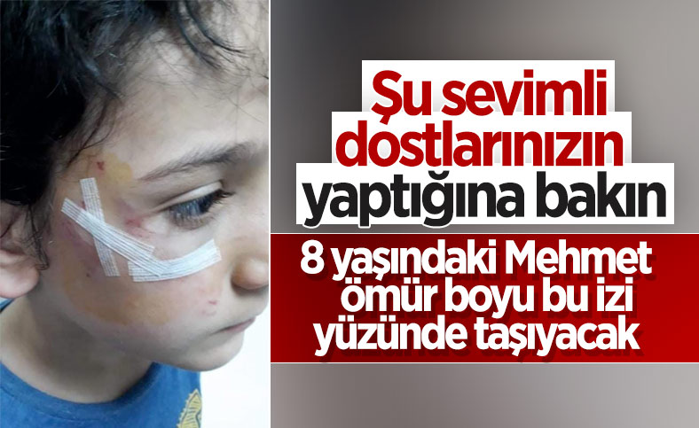 Bursa’da sokak köpeği 8 yaşındaki çocuğa saldırdı 
