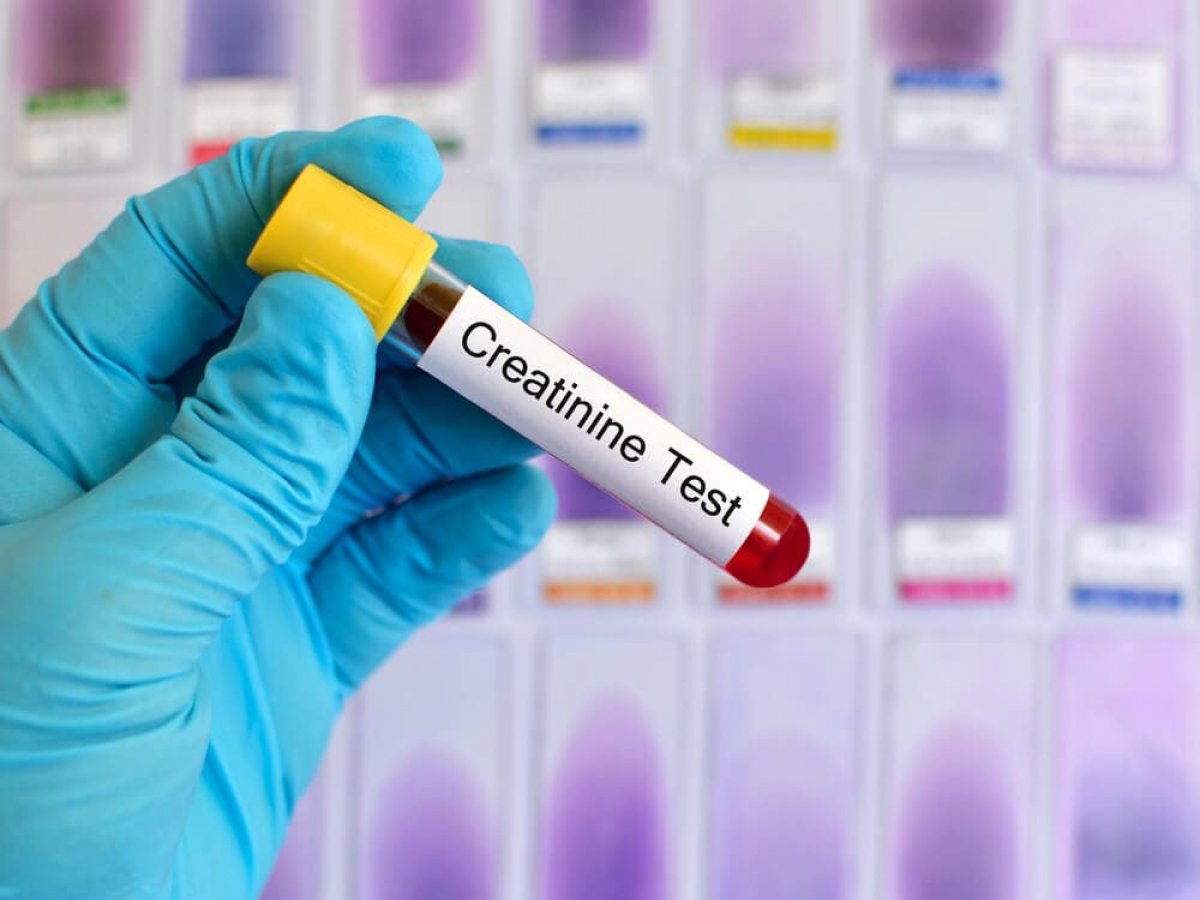 What is creatinine #3