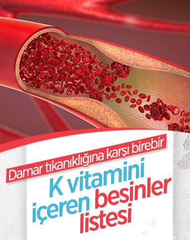 K vitamini, damar tıkanıklığını önlüyor