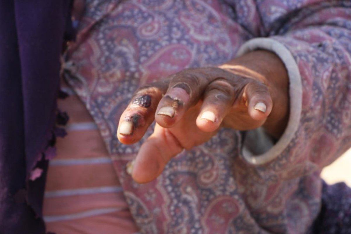 Manavgat taki yangında alevlerin arasında kaldılar #1