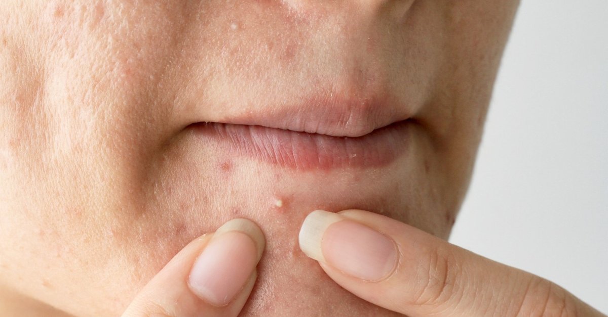 Hayatınızı kurtarabilecek çok basit 6 sağlık muayenesi #7