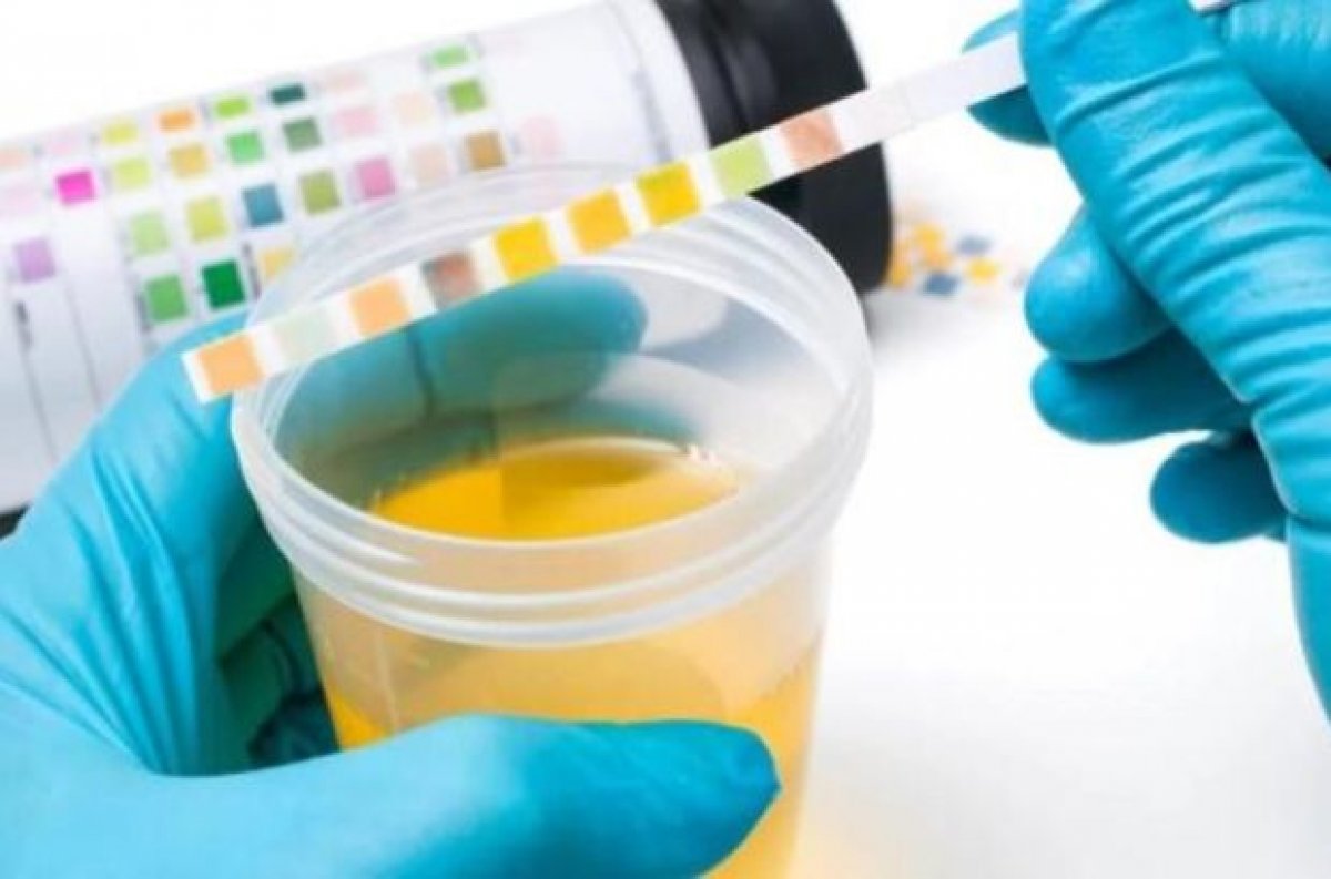 Hayatınızı kurtarabilecek çok basit 6 sağlık muayenesi #4