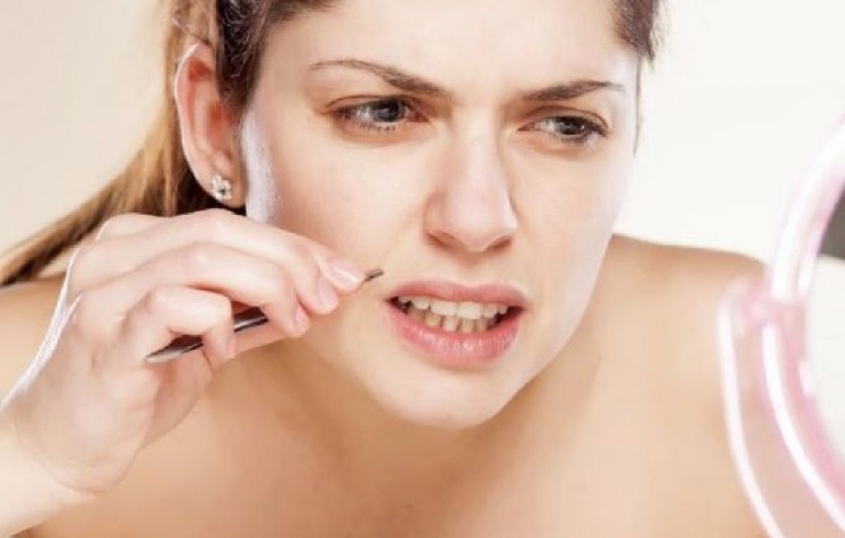 Aşırı tüylenme ile kendini gösteren hastalıklar #2