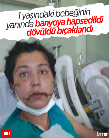 İzmir’de, 1 yaşındaki bebeğinin yanında dövülüp bıçaklandı 