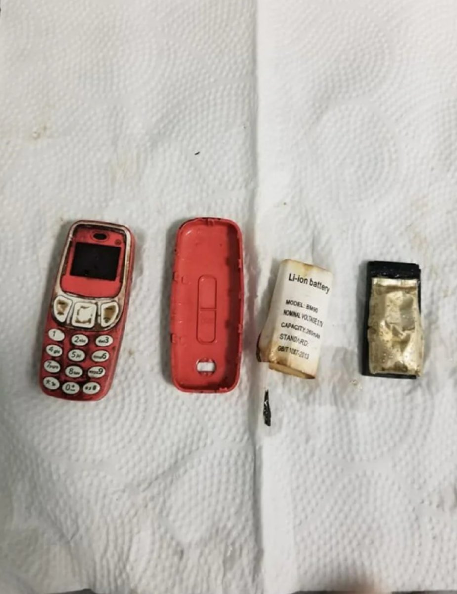 Kosova da midesinden Nokia 3310 çıktı  #2