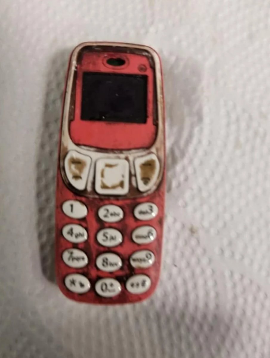 Kosova da midesinden Nokia 3310 çıktı  #3
