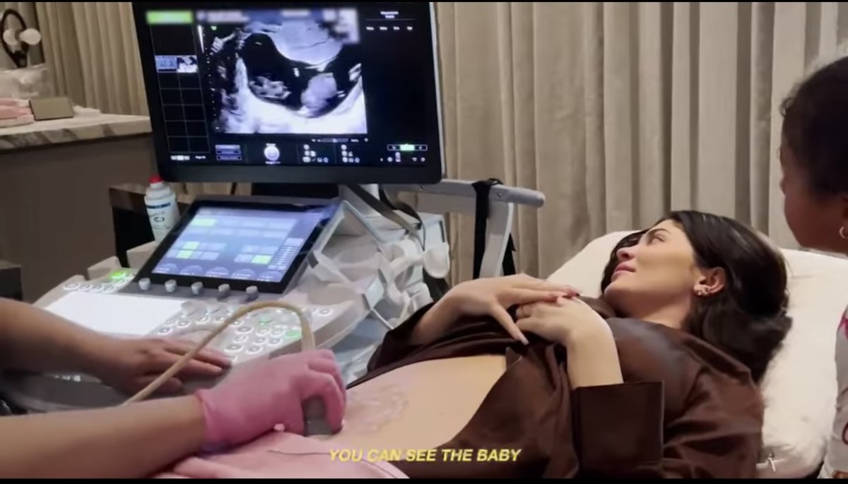 Stormi ye kardeş geliyor! Kylie Jenner den ikinci kez  hamileyim  videosu #3