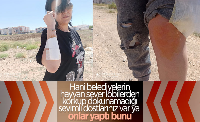 Ankara'da bir kadın, 12 köpeğin saldırısına uğradı