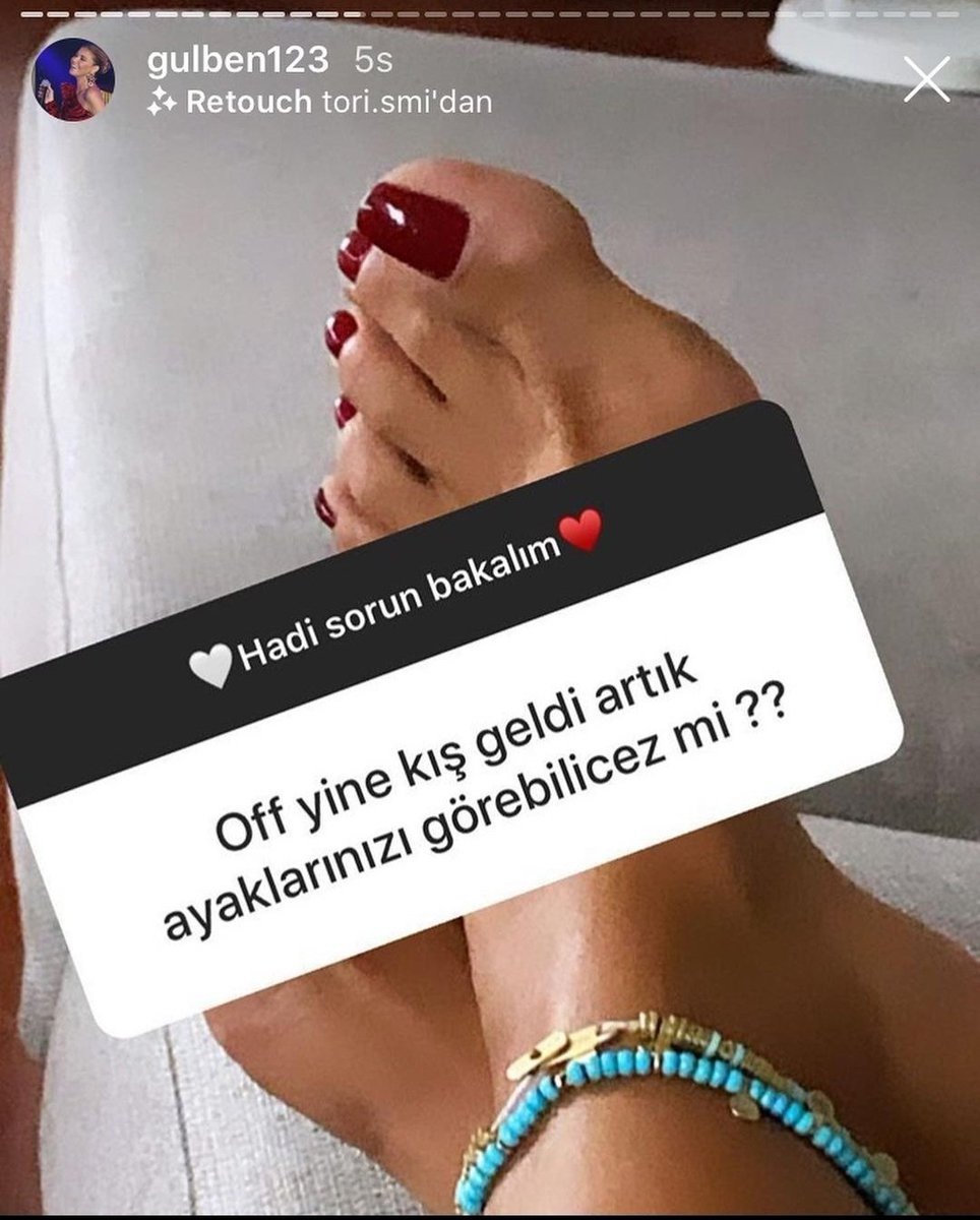 Uğruna fan hesapları açılmıştı! Gülben Ergen, ayağını sakatladı #2