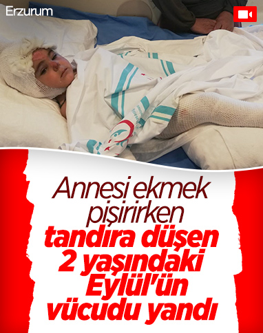 Erzurum’da, tandıra düşen 2 yaşındaki çocuğun vücudu yandı 