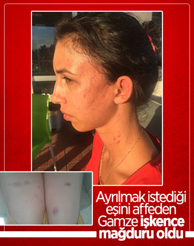 Adana'da eşine işkence yapan koca, polisi harekete geçirdi