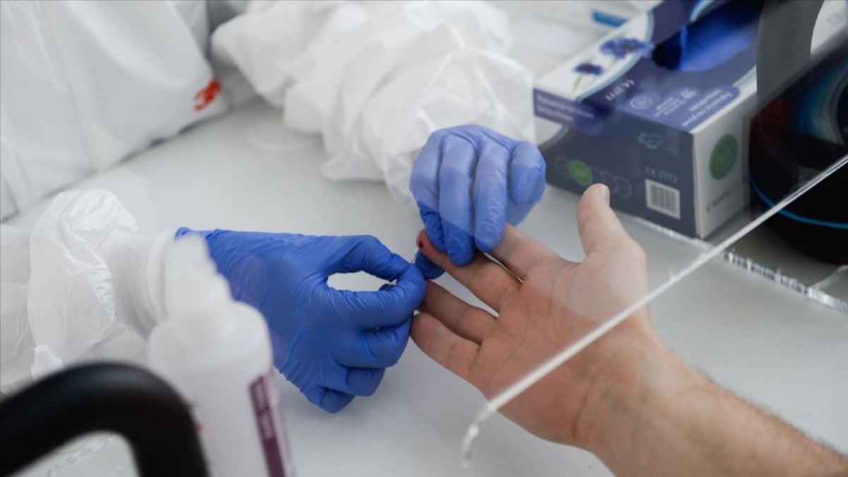 DSÖ, ilk kez bir koronavirüs antikor test kitine uluslararası lisans verdi #2