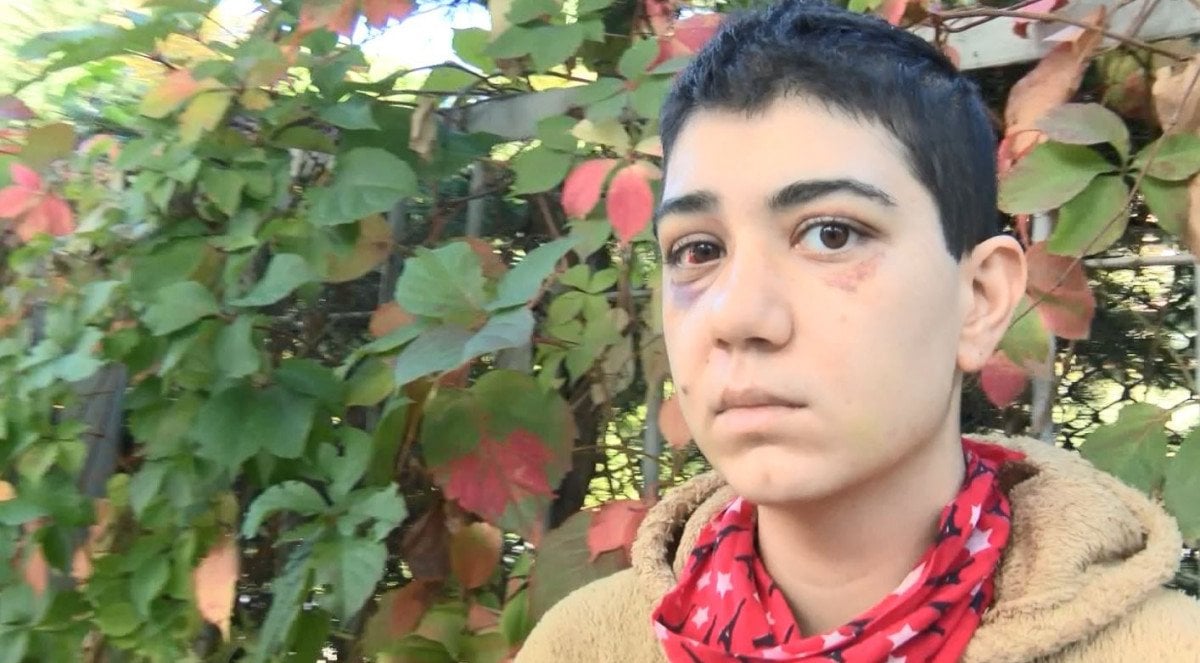 Beyoğlu nda saldırı sonrası yüzü kısmi felç oldu #4