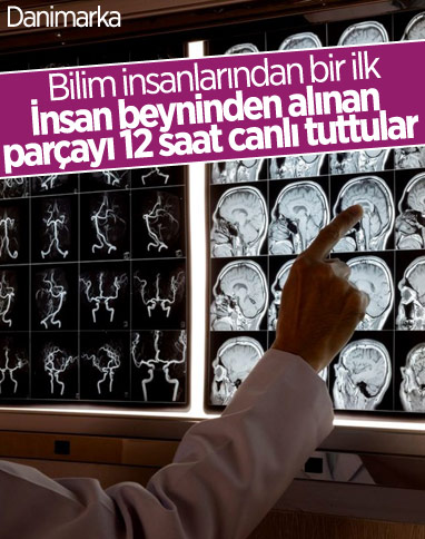 Danimarka'da insan beyninden alınan bir parça 12 saat canlı tutuldu