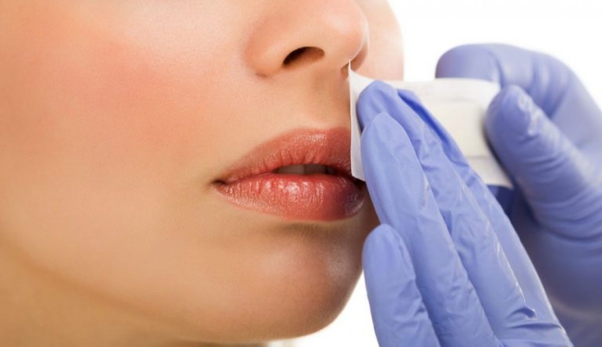 Bıyık bölgesi kararmalarına etkili çözüm... #2