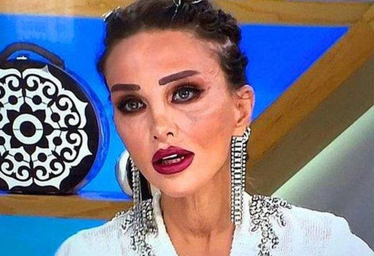 Seren Serengil’in eski doktorundan açıklama geldi #2