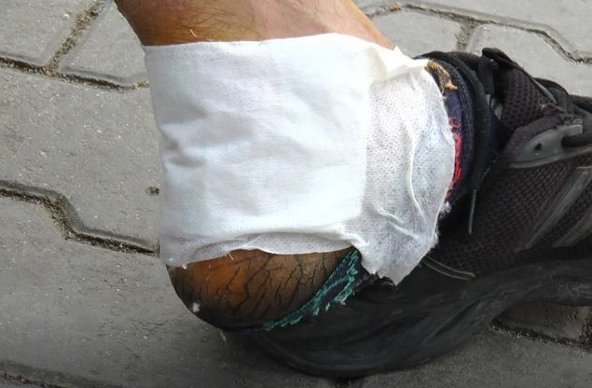 Gaziantep te ikinci pitbull vakası #2