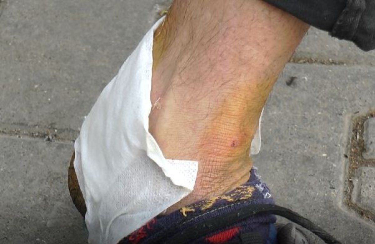 Gaziantep te ikinci pitbull vakası #1