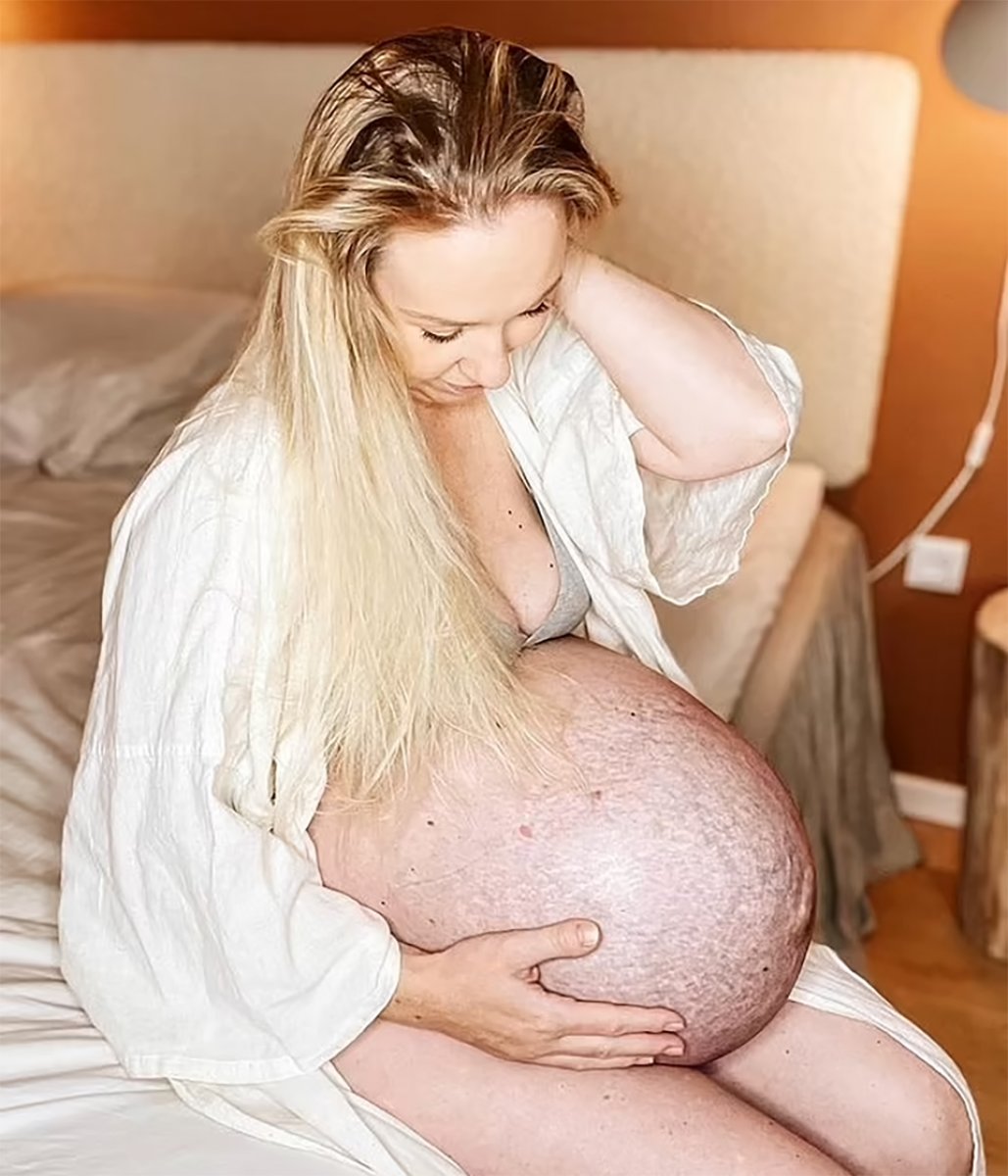 Danimarka da üçüz doğuran kadın, sosyal medyanın gündemine oturdu #4