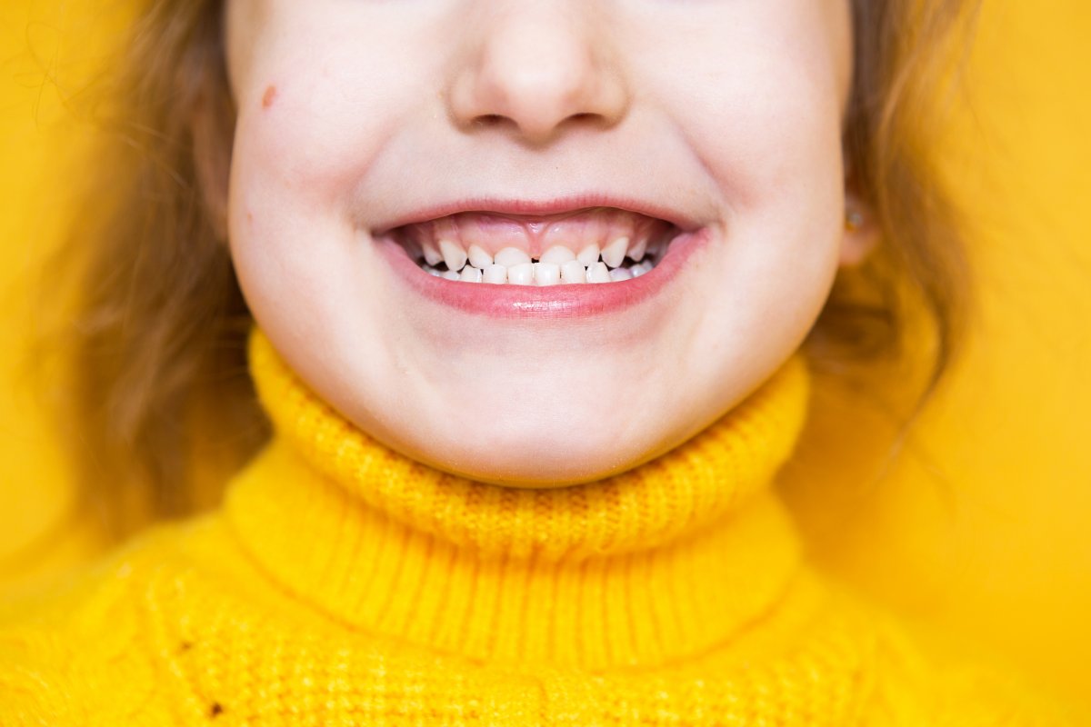 4 main reasons why children grind their teeth during sleep #2