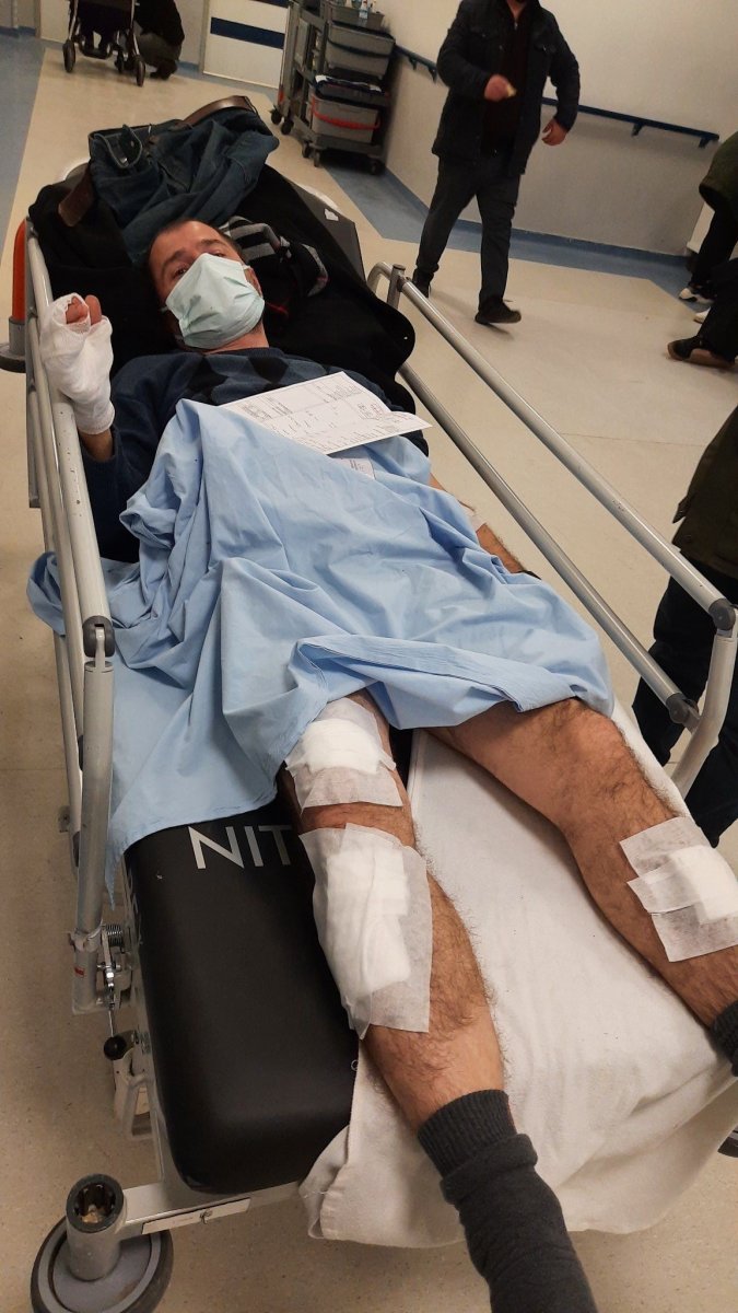 Ankara da başıboş köpek saldırısına uğrayan adam ağır yaralandı #2