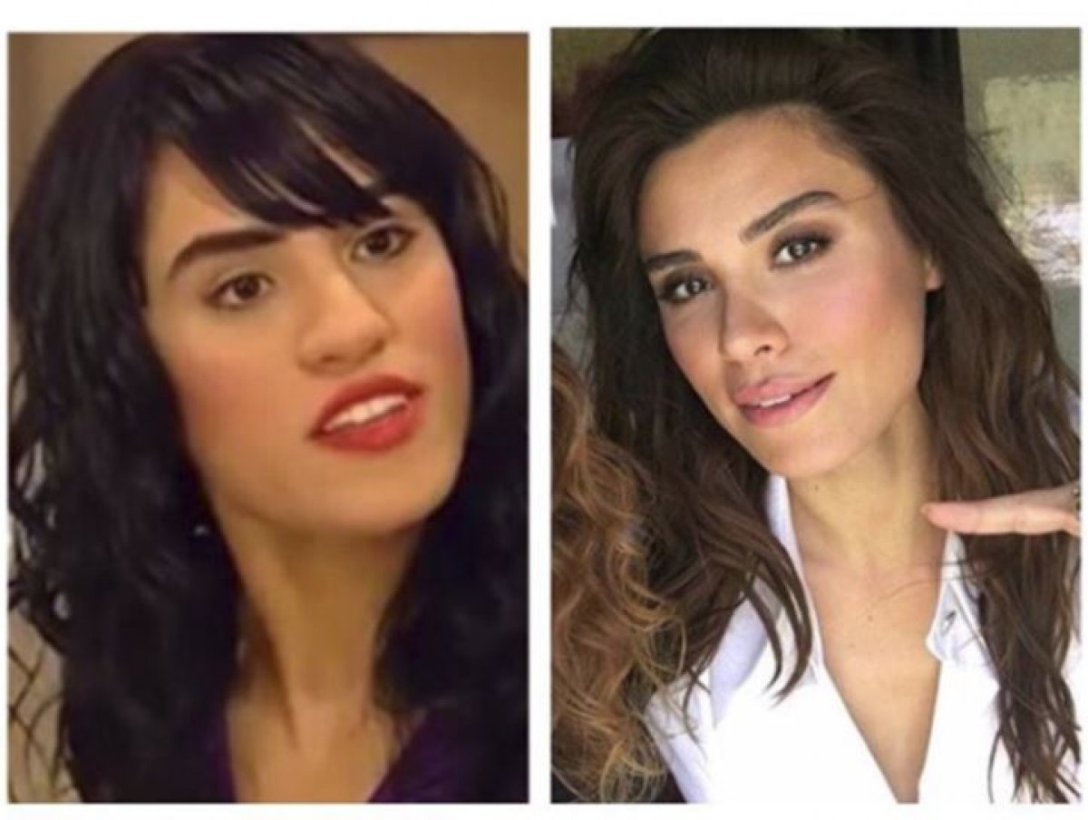 Турецкие актрисы до и после пластики