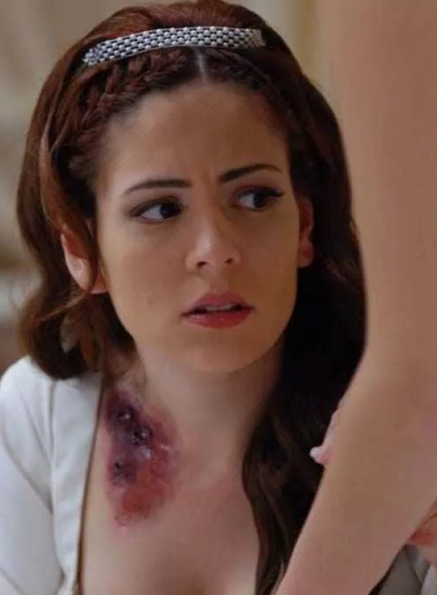 Osman Bey in cesur hatunu Malhun un eski karelerini gören şoke oldu!  Sivilcelerinden nasıl kurtuldun?  #4